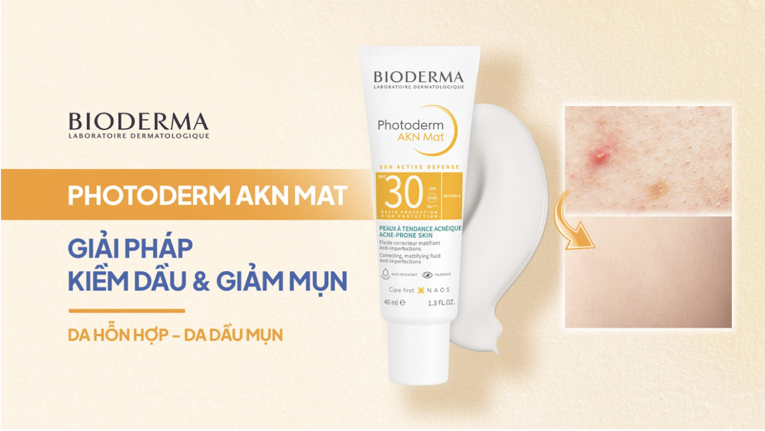 Kem chống nắng kiềm dầu Bioderma Photoderm AKN Mat SPF 30