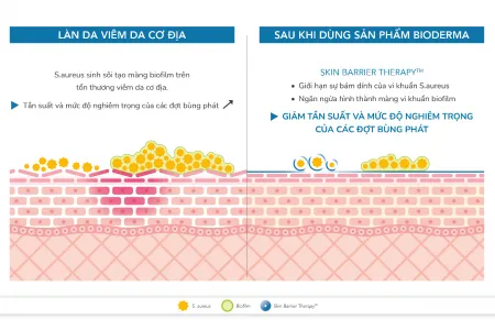 Da khô rát, nứt nẻ