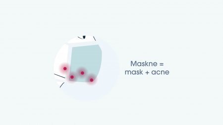 Maskne_maskne