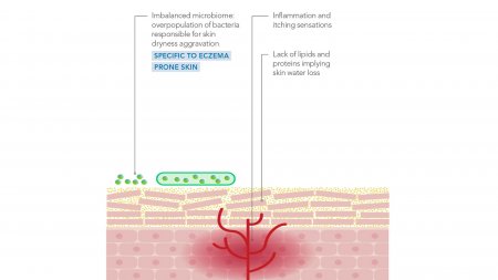 Graphical representation of the behaviour of skin suffering from atopic dermatitis.