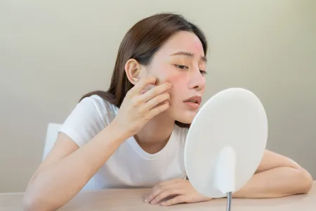 5 lợi ích của kem phục hồi cho da treatment